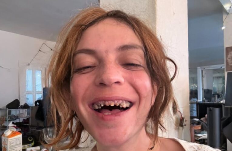 Así cantaba Camilín, el hijo de Camilo Sesto que perdió los dientes por las drogas